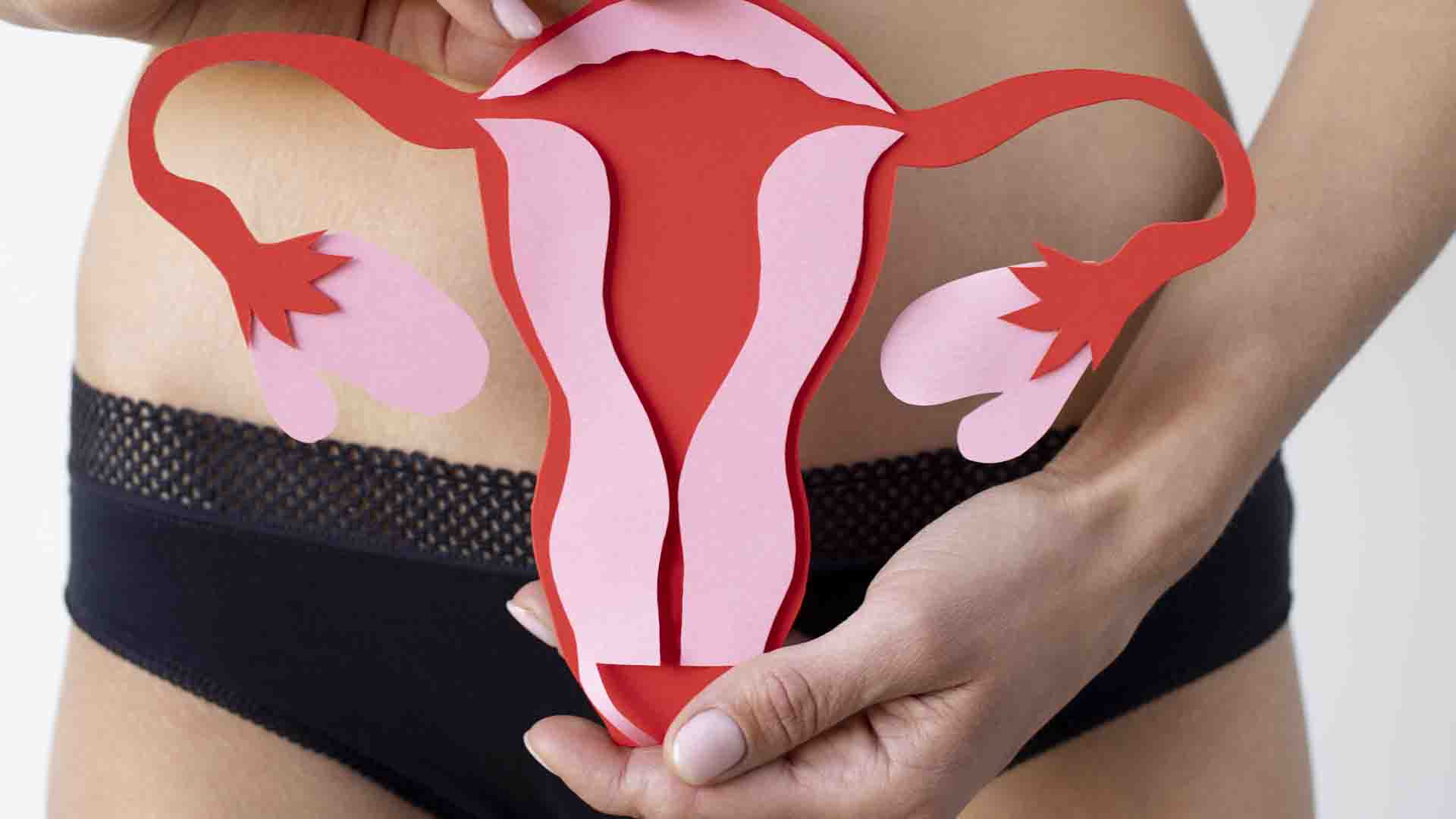Santé : comprendre le syndrome des ovaires polykystiques ou SOPK en 6  questions